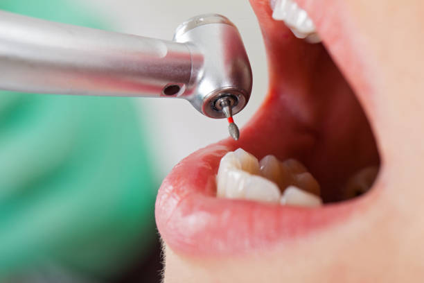 Emergency Gum Pain Relief in NY